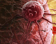 Rak atakuje komórki organizmu w cukrzycy
